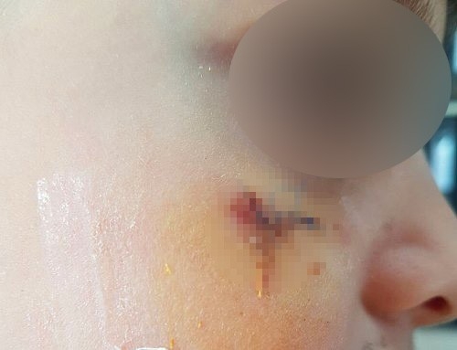 Öğrencisini Kitapla Yaralayan Öğretmen Hakkında Karar: 4 Yıl 2 Ay Hapis