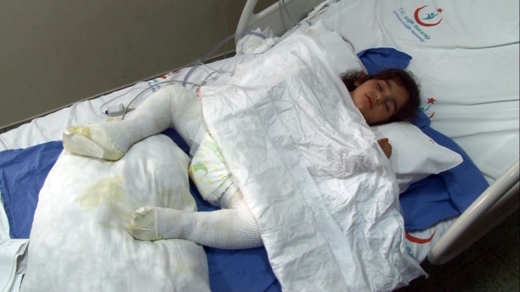 Oyun Oynayan Çocuk Tandıra Düşerek Feci Şekilde Yandı