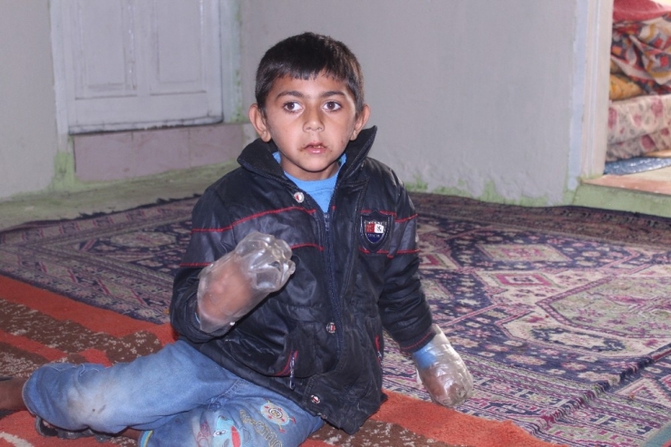 Minik Yusuf’un Dramı: Sürekli Isırdığı Ellerini Plastik Şişeye Bağlıyorlar