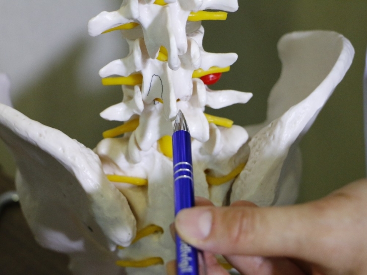 Bel Fıtığı Tedavisinde Tam Kapalı Cerrahi Yöntemi Konfor Sağlıyor