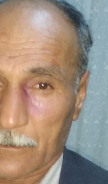 Eşini Ve Babası Şehit Olan Köy Korucusu Saldırıya Uğradı