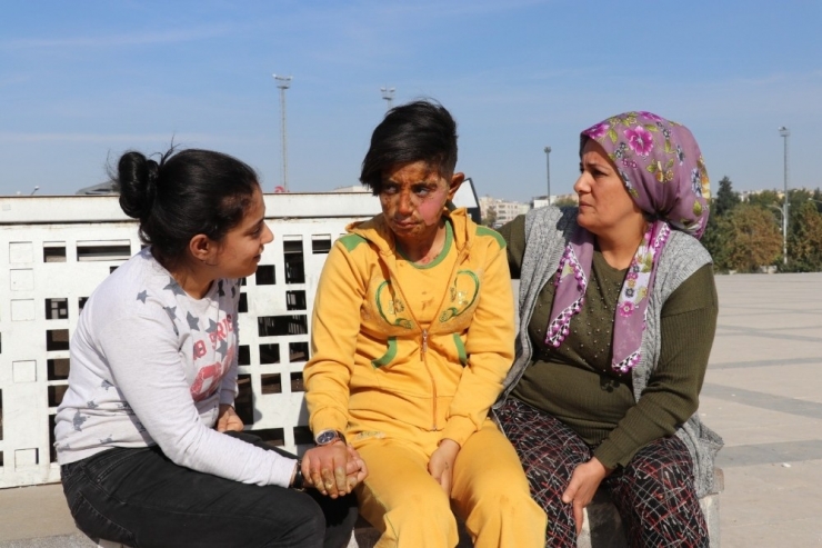 Kendisini İhbar Eden Genç Kızı Üzerine Benzin Döküp Yakan Cani Yakalandı