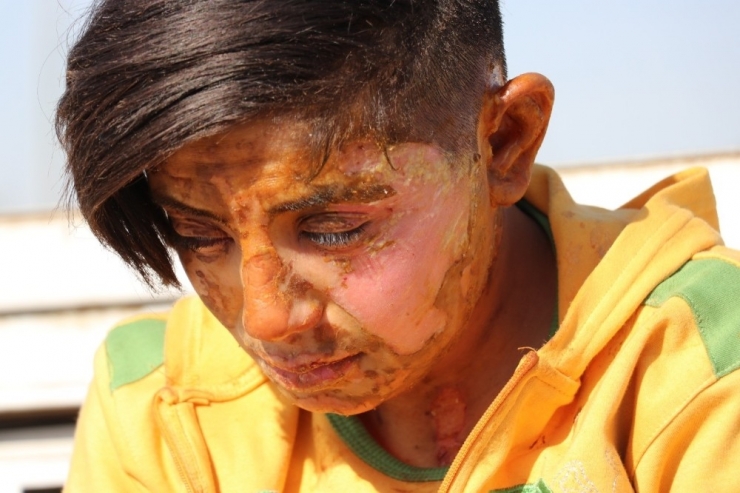 Kendisini İhbar Eden Genç Kızı Üzerine Benzin Döküp Yakan Cani Yakalandı