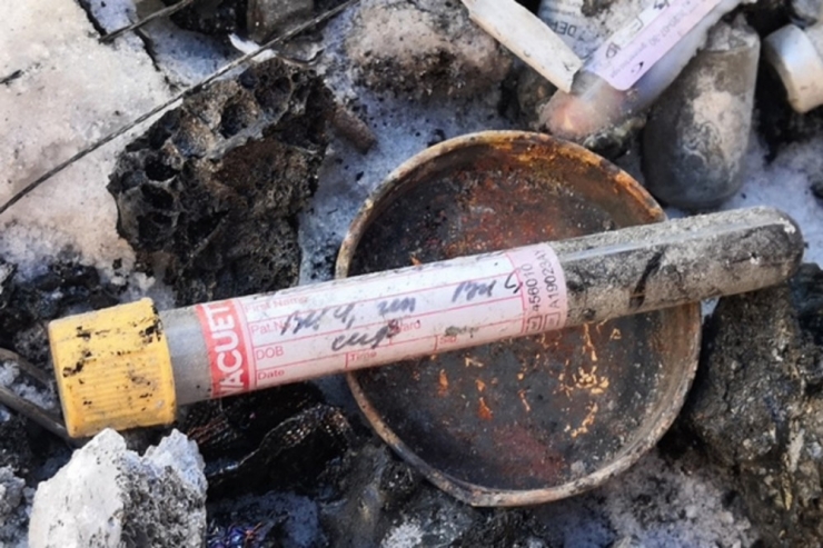 Rusya’da ’Hıv’ Alarmı