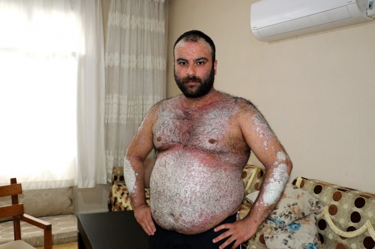 Kimse Korkmasın Diye Dışarı Çıkmıyor