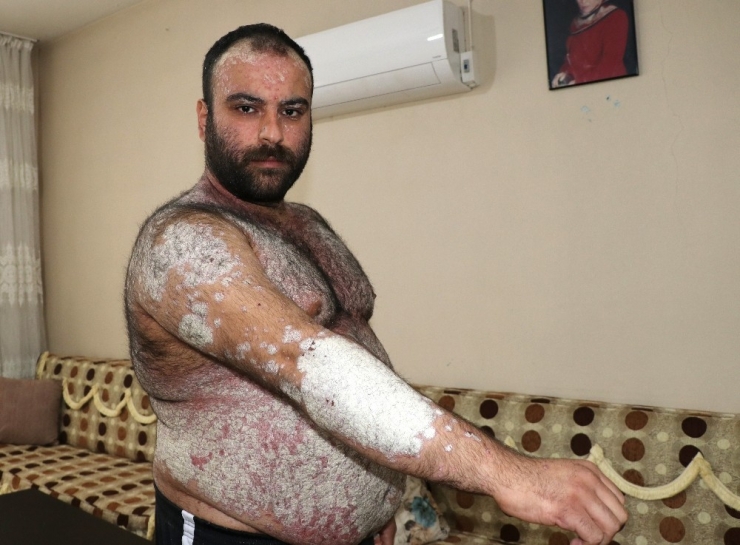 Kimse Korkmasın Diye Dışarı Çıkmıyor