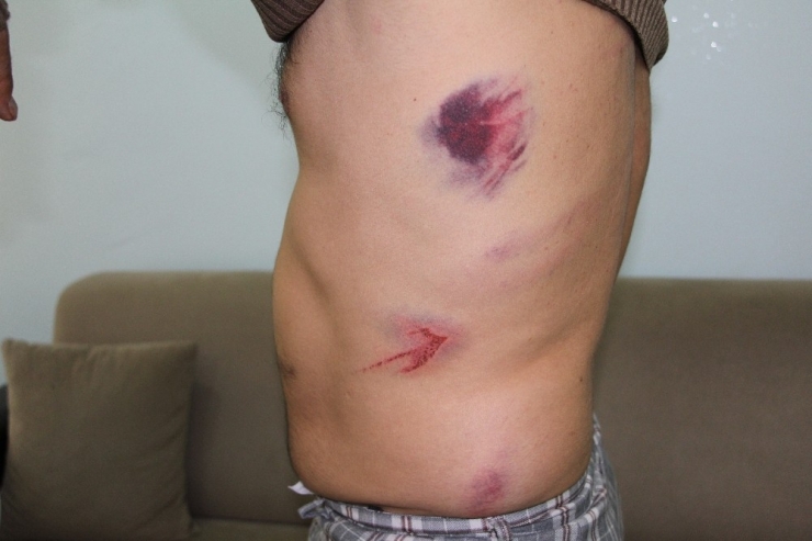 Batman’da Teknik Direktör Ve Sporculara Demir Çubuklarla Saldırı