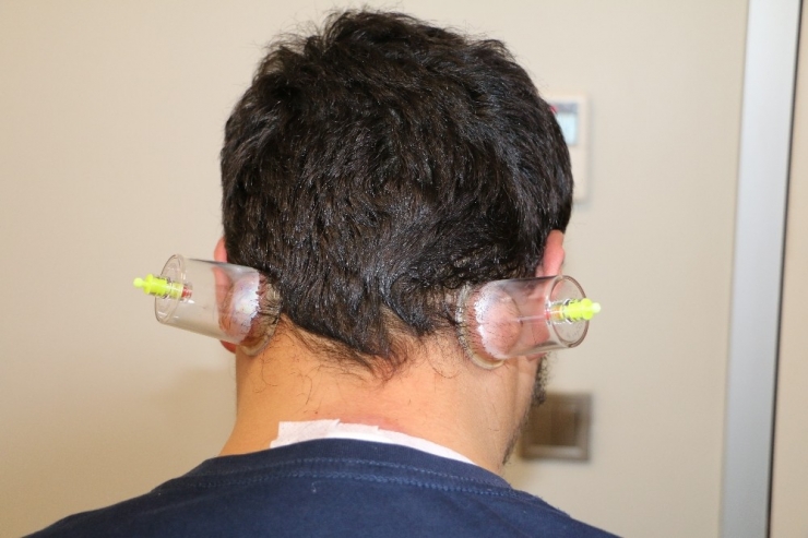 Soğuk Hava Migrenine Hacamat