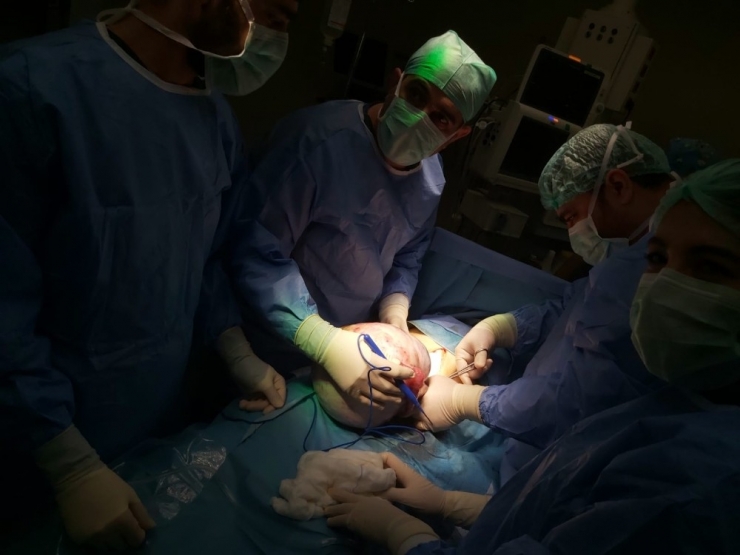 Ağrı Şikayetiyle Hastaneye Giden Kadının Karnından 4 Kiloluk Tümör Çıktı