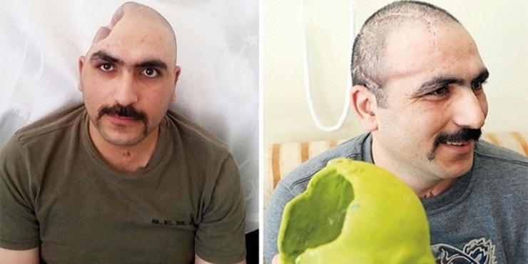 Bu Merkezde "İnsan Yedek Parçası" Üretiliyor