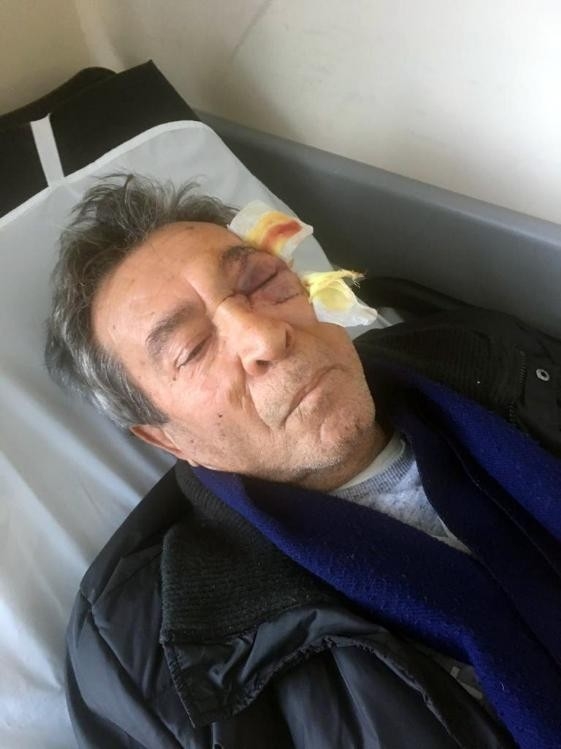 Yaşlı Adama Yumruk Atan Sağlık Memuru Konuştu: