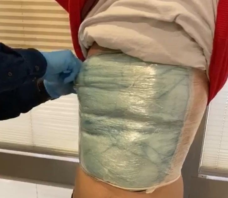 Streç Filmle Vücuduna Sardığı Uyuşturucuyla Uçağa Binmek İsterken Yakalandı