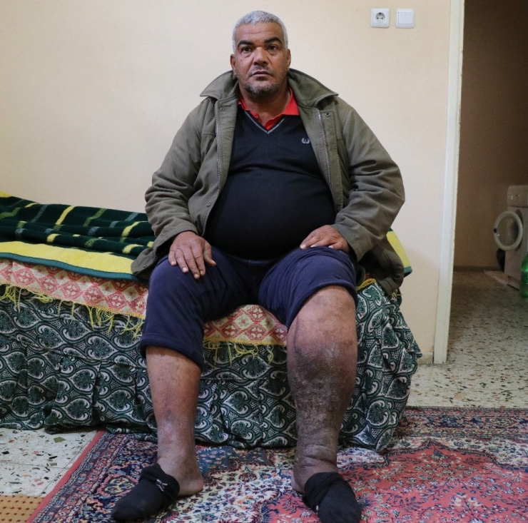 Varis Ameliyatı Oldu, Fil Hastası Çıktı