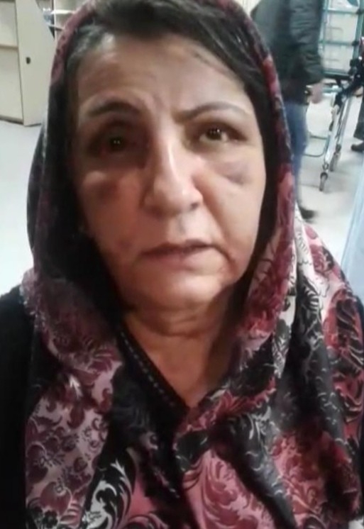 Elazığ’da Bir Annenin Darp Edilmesiyle İlgili Savcılıktan Açıklama