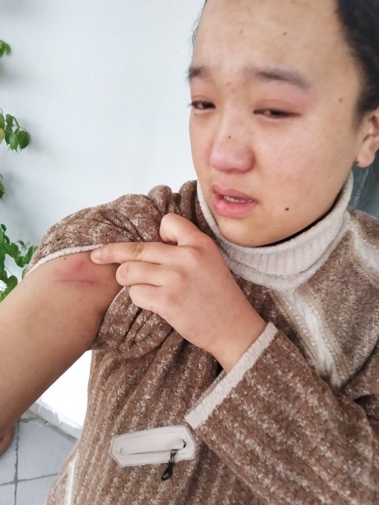 Şiddete Uğradığını İddia Eden Nepalli Genç Kız Sosyal Medyadan Yardım İstedi