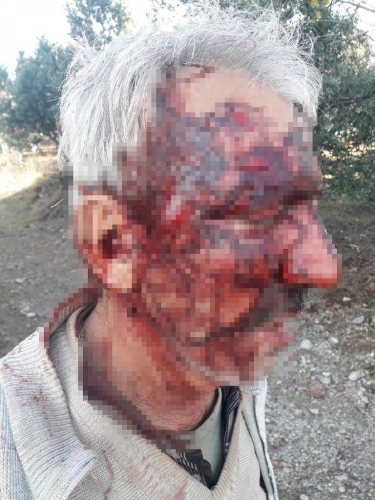 Engelli Vatandaşı Öldüresiye Dövüp Çukura Attı