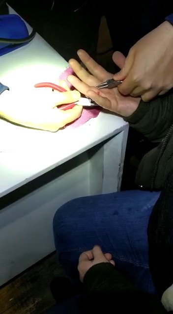 Parmağına Yüzük Sıkışan Kadın Soluğu İtfaiyede Aldı