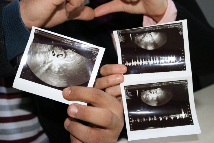 Çocuğu Olmayacak Denilen Kadın İkiz Gebelik Yaşıyor