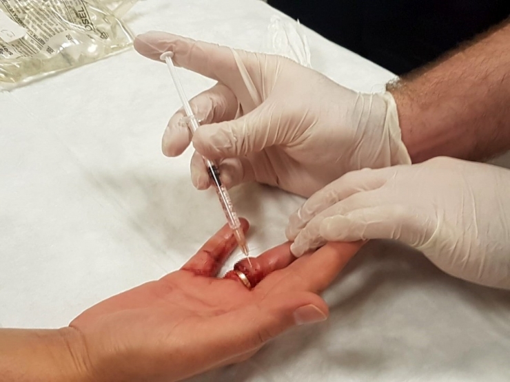 Evde Temizlik Yaparken Düşen Kadın Neredeyse Parmağından Olacaktı