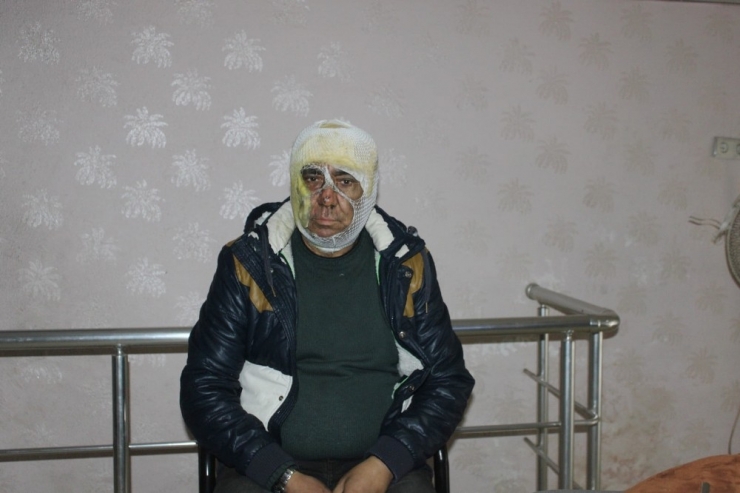 Evinde Çıkan Yangını Söndürmek İsterken Yaralandı