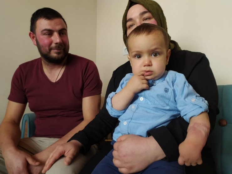 Minik İsa’nın Kolundaki Yanık, Elini Kullanamaz Hale Getirdi