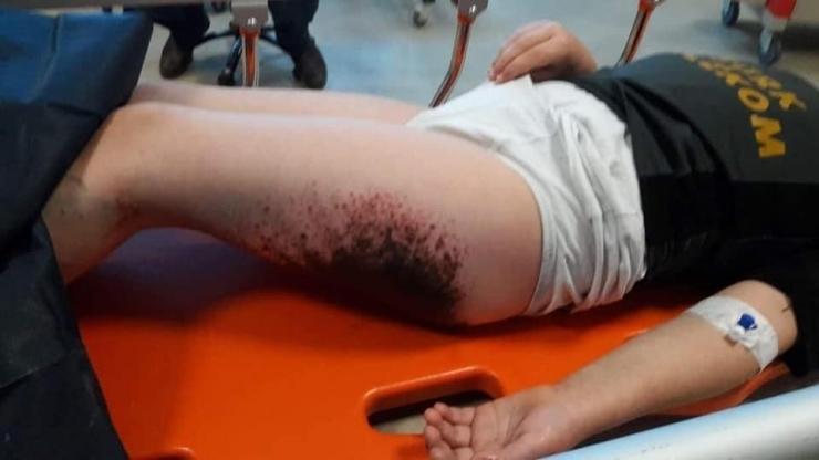 Yanan Çocuklarla İlgili Profesörün Açıklamalarına Tepki