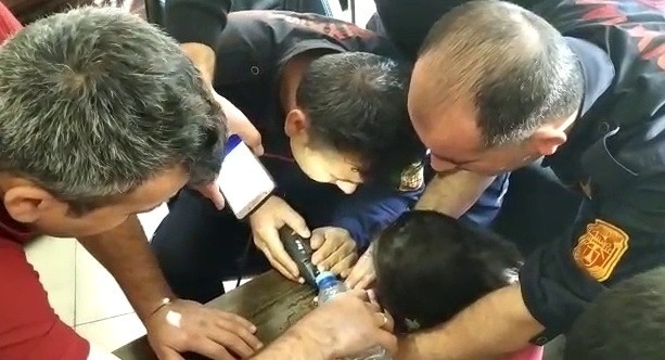 Parmağındaki Yüzük Kesilerek Çıkarıldı