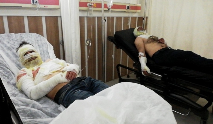 Sobayı Benzinle Tutuşturmaya Çalışan İki Arkadaş Kendilerini Yaktı