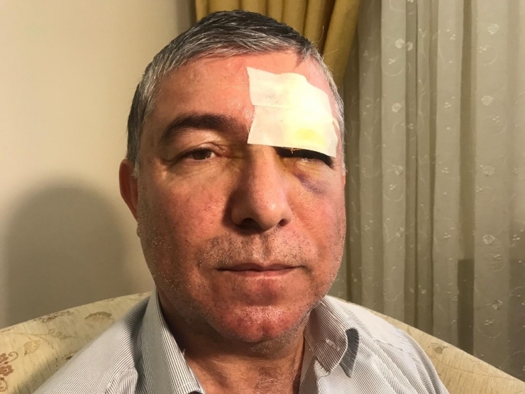 Ümraniye’de Muştalı Dehşet: 1 Yaralı