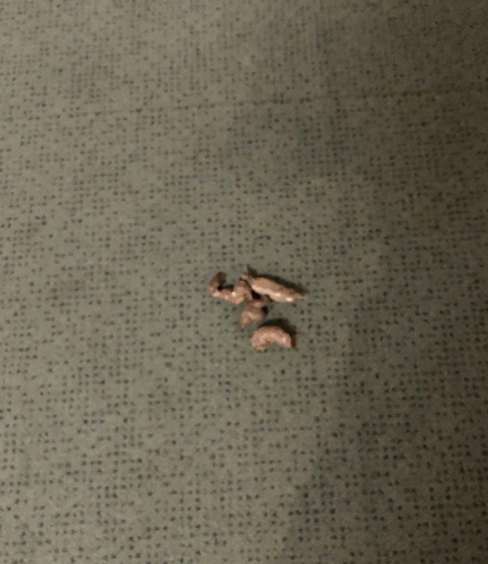 İngiltere Parlamento Binasında Tilki Paniği