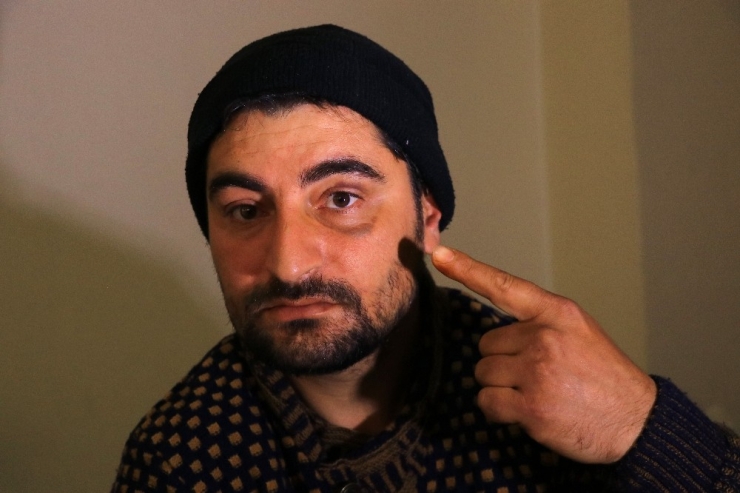 Yanlarında Çalıştırdıkları İşçiyi Darp Edip, Kimliğine El Koydular