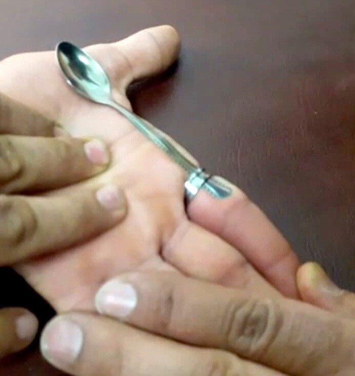 Yüzüğe Sıkışan Parmağı İtfaiye Kurtardı