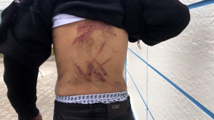 ‘Komşu Zulmü’ Kaldığı Yerden Devam Ediyor