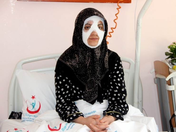 Bomba Gibi Patlayan Düdüklü Tencere Genç Kadına Dehşeti Yaşattı