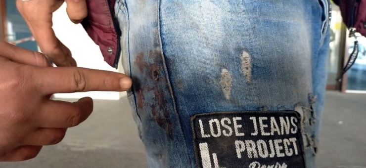 Yunanlılar Tarafından Vurulan Göçmen Yaşadıklarını Anlattı