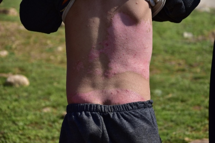 Mayınla Oyun 5 Kardeşten 3’ünün Hayatına Maloldu