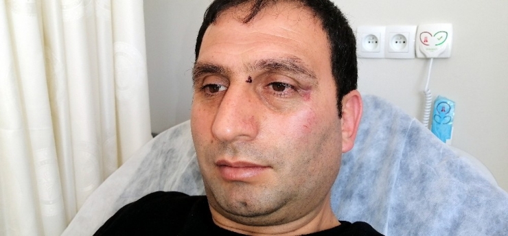 Erzincanspor Yöneticileri Gazeteciyi Döverek Hastanelik Etti