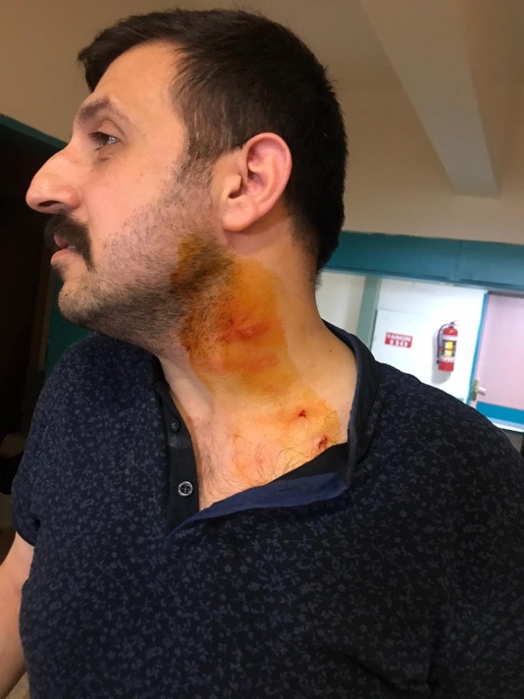 Hasta Yakını, Sağlık Çalışanını Isırıp, Darp Etti