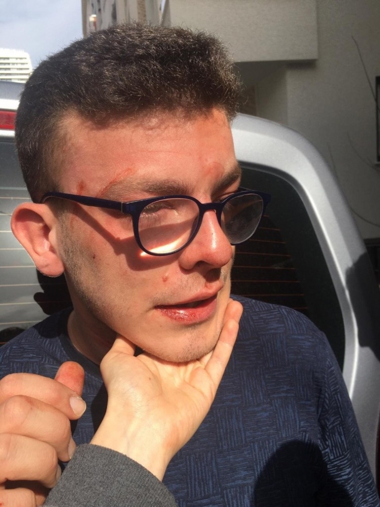 Avcılar’da Otizimli Genç Sokak Ortasında Dehşeti Yaşadı