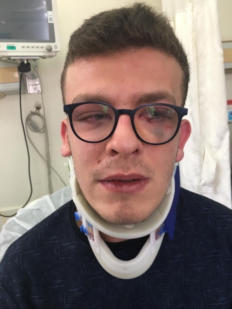 Avcılar’da Otizimli Genç Sokak Ortasında Dehşeti Yaşadı