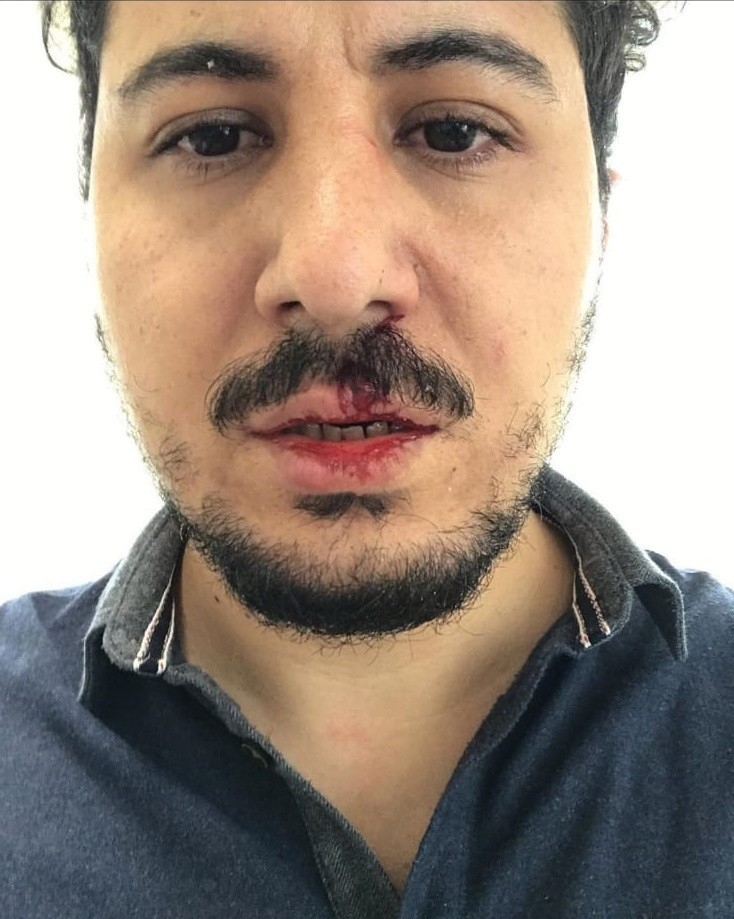 Çocuğuna İlaç Yazmayan Doktoru Darp Ettiği İddiası