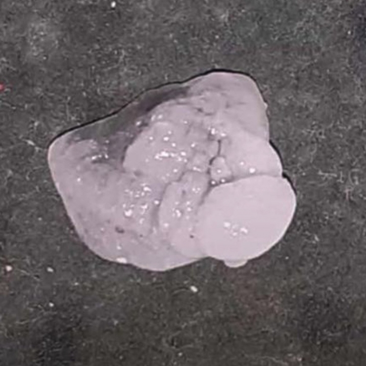 Araban’da Şiddetli Dolu Yağışı