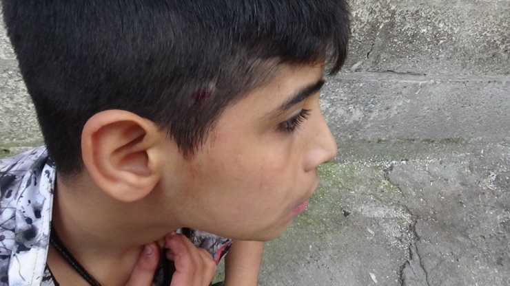 Diyarbakır’da Silahlı Kavgada Top Oynayan Çocuk İle Birlikte 3 Kişi Yaralandı