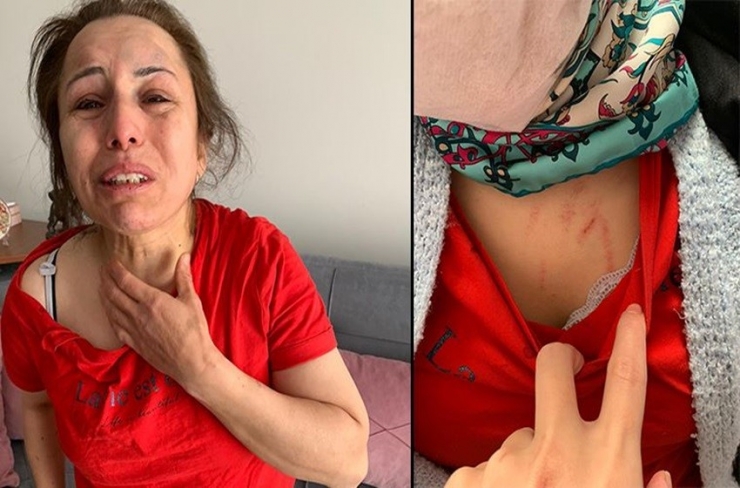 Şiddete Uğrayan Kadından, Kocasına Yardım Eden Zanlı Hakkında Suç Duyurusu