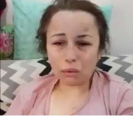 Şiddete Uğrayan Kadından, Kocasına Yardım Eden Zanlı Hakkında Suç Duyurusu