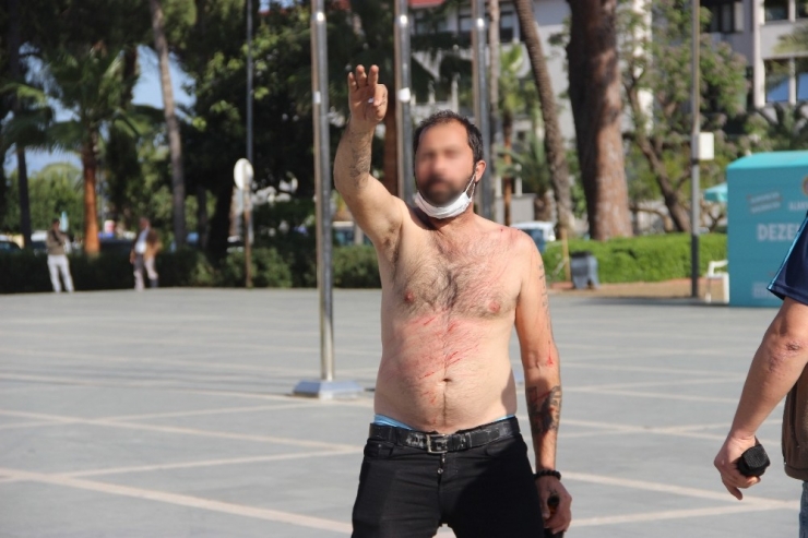 Kesici Aletle Kendilerine Zarar Veren 2 Kardeşi Sosyal Mesafe Tanımadan İzlediler