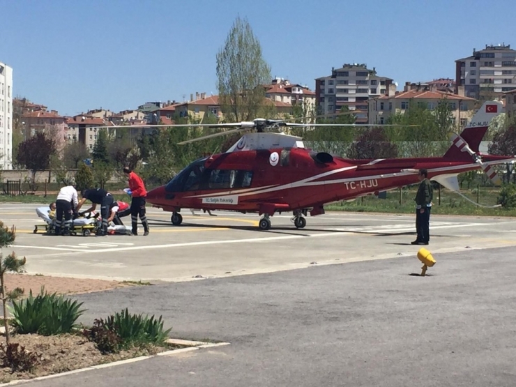 Odun Kesmek İsterken Kolunu Kesti