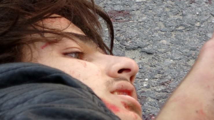 Araca Kaldırım Taşı Atan Genci Bıçakladılar