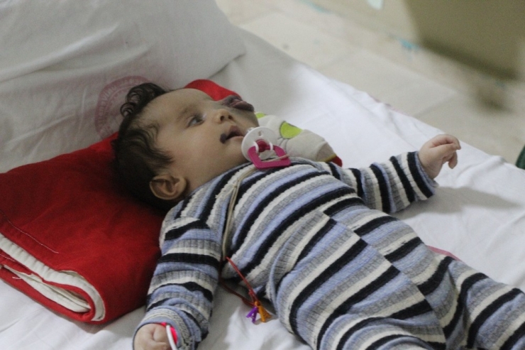 Suriyeli Yusuf Bebek Türkiye’de Tedavi Ediliyor