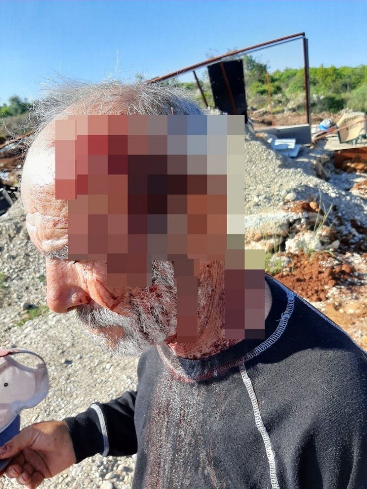 Arazi Kavgasında Yaşlı Adamın Demir Çubukla Darp Edildiği İddiası